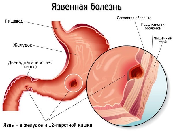 Польза калины для организма. Рецепты применения для женщин, мужчин и детей